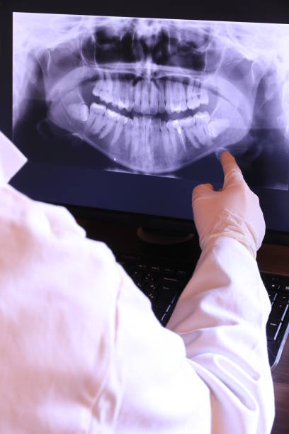Best Emergency Dental Care for Broken or Chipped Teeth in Wakeeney, KS
