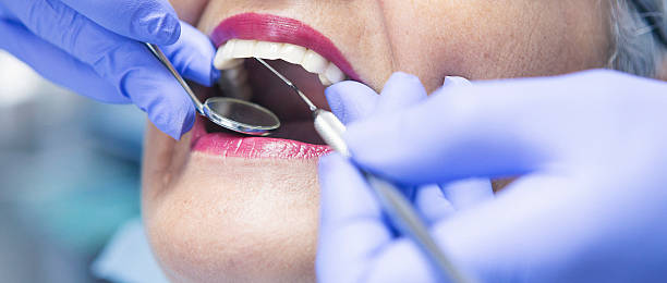 Best Emergency Wisdom Teeth Removal in Wakeeney, KS